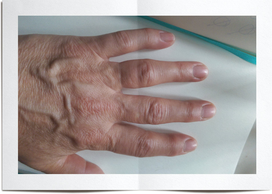 Can I Wear A Ring If I Have Big Knuckles?